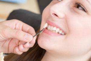 ホワイトニングができない人っているの？体への影響は？