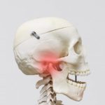 口が開かない？～顎関節症の原因って何～