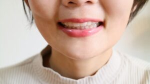 口元が出ている？～ロゴボってしっていますか？～